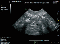 Cat Intestine