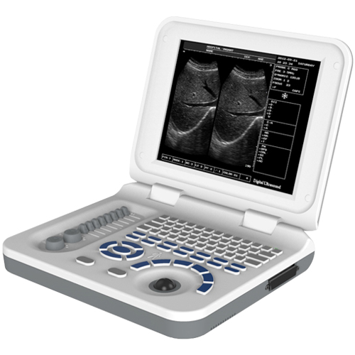 Laptop Portable Ultrasound LT30