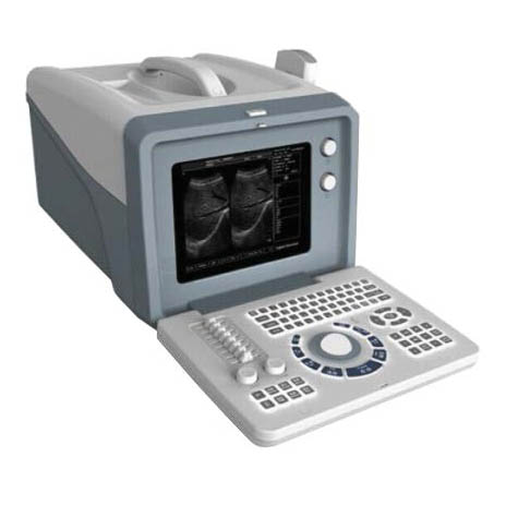 Portable Ultrasound Scanner P360