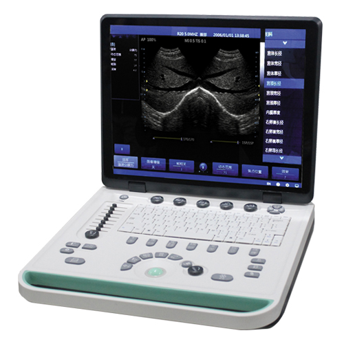 Portable Ultrasound System P4 Plus