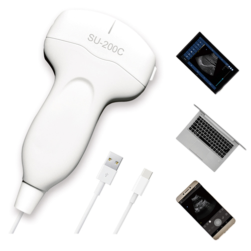 USB Portable Ultrasound System